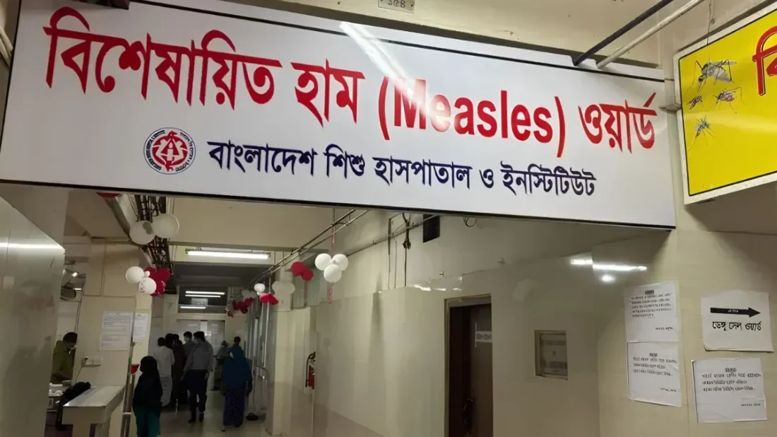 দেশে হামের উপসর্গে আরও ৭ জনের মৃত্যু